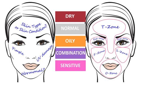 Types Of Skin Breakdown