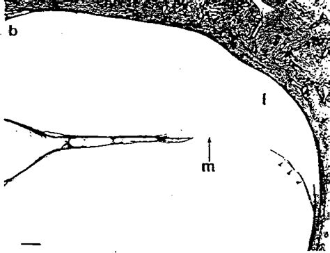 Figure 5 from STRUCTURE AND FUNCTION IN WHALE EARS | Semantic Scholar