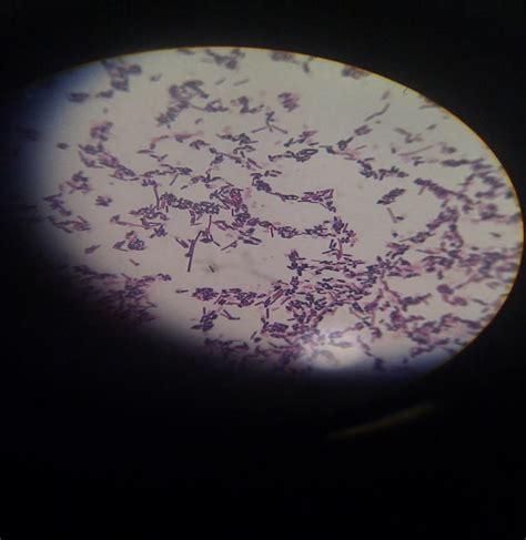 Clostridium tetani with terminal spores in certain morphology called... | Download Scientific ...