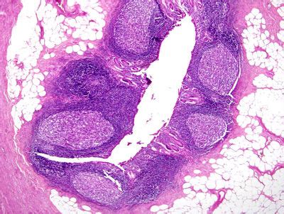 Appendix Histology