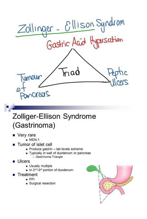 Zollinger-ellison syndrome... MEN 1 | Medical ultrasound, Medical ...