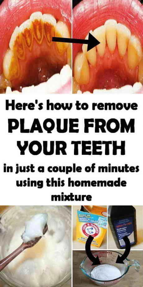 Remove Plaque From Your Teeth With This Homemade Mixture. in 2020 | Homemade mouthwash, Teeth ...