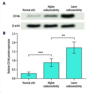 CD146 is up-regulated in cervical cancer cells, especially those with... | Download Scientific ...