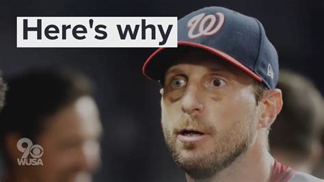 Why are Max Scherzer's eyes two colors? | wusa9.com