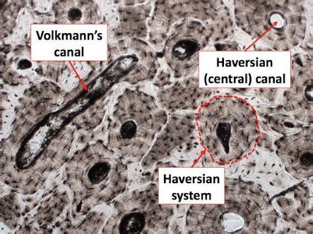 volkmann canal - ค้นหาด้วย Google | Tissue engineering, Anatomy and ...