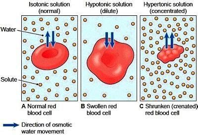 hypertonic vs hypotonic - Google Search | Nurse teaching, Nursing ...