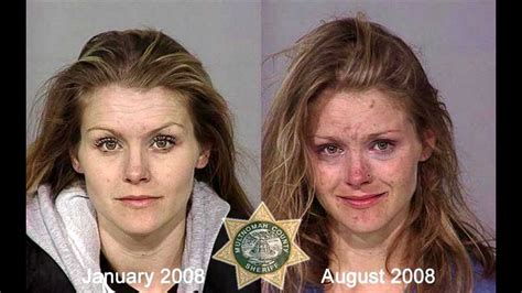 What Do Drug Addicts Look Like? - Recovery Ranger