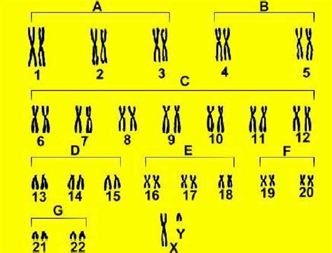 Human Karyotype of a Male (44,XY) | Download Scientific Diagram