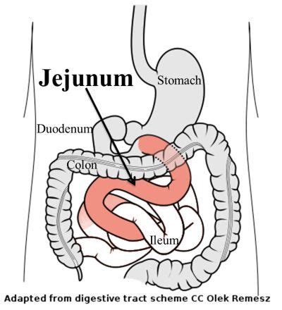 17 Best images about jejunum on Pinterest | The smalls, Stains and Lost