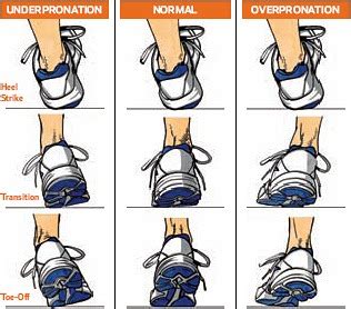 Forefoot Striking and Pronation: Insight from an Ultrarunning Podiatry Student