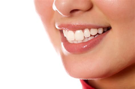 Why Choose Clear Braces? - Northwoods Dentistry