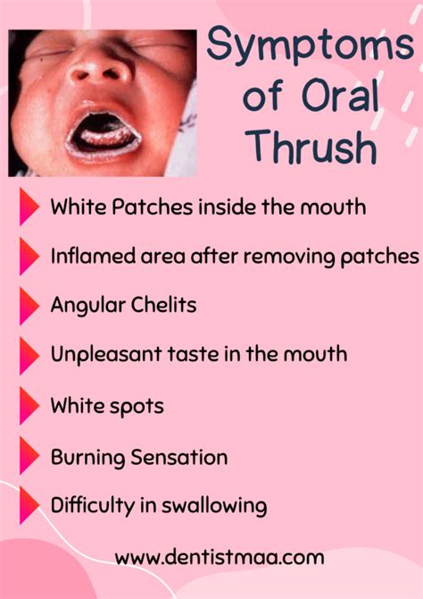 Oral thrush (Oral Candidiasis): Proven Facts - DentistMaa