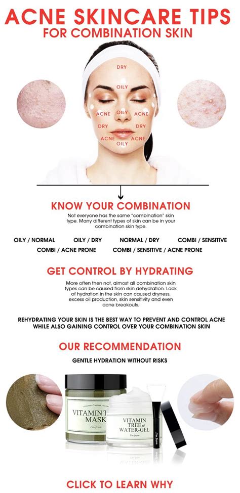 ACNE SKINCARE TIPS FOR COMBINATION SKIN - WISHTREND GLAM | Combination ...