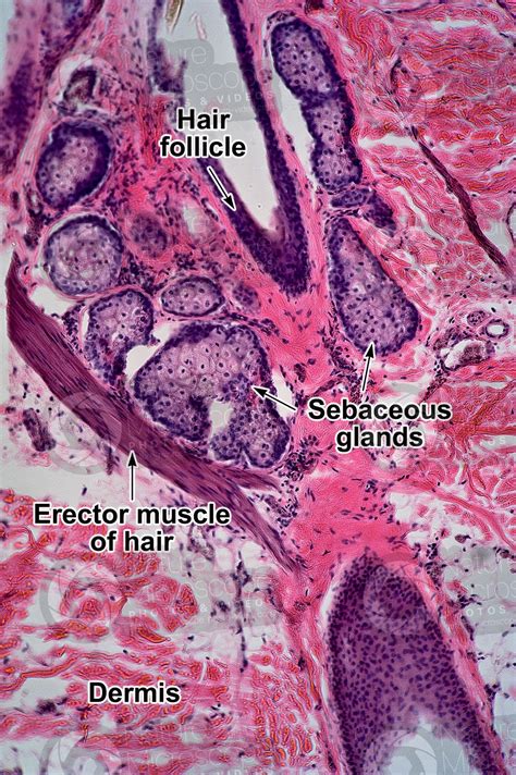 Man. Sebaceous gland. Vertical section. 250X - Sebaceous gland - Mammals - Integumentary system ...