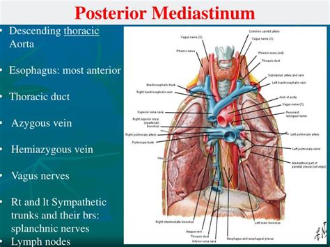 PPT - Mediastinum PowerPoint Presentation - ID:5617803