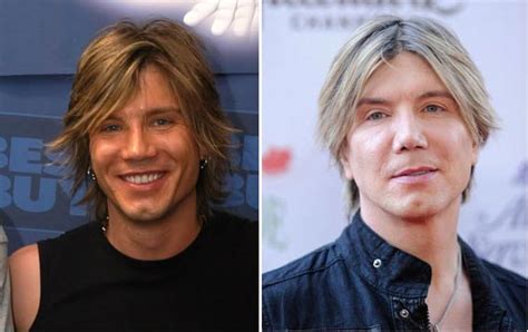 John Rzeznik Plastic Surgery Before & After - Plastic Surgery Talks