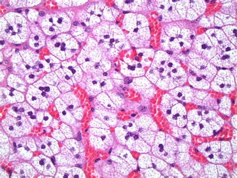 Pathology Outlines Normal Histology