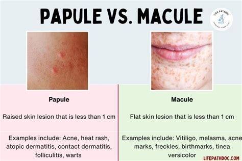 Papule vs Macule: Pictures, Differences, and Causes