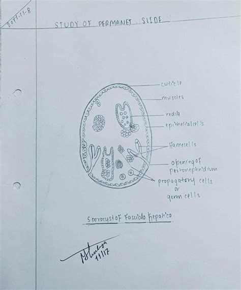 Fasciola Hepatica:Sporocyst and Redia Larva Comment Diagram | Permanent ...