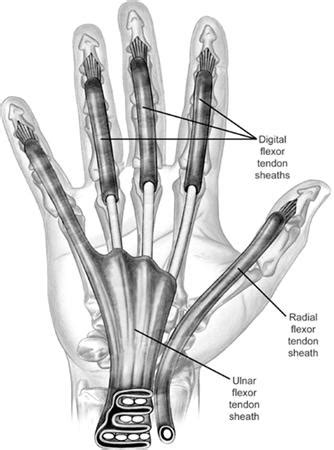 Flexor Tendon Injuries - Hand - Orthobullets