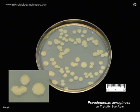 Pseudomonas Aeruginosa Colony Morphology