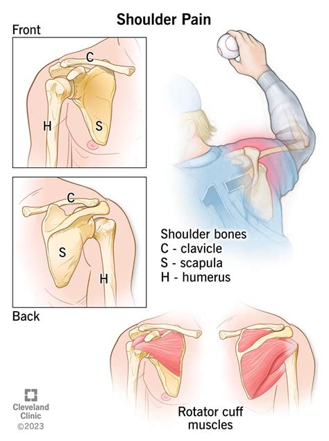 Shoulder Pain Causes & Treatment