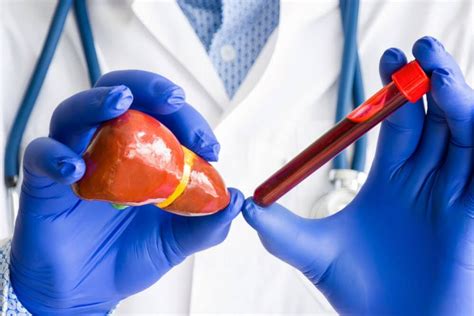 When to Worry about ALT Levels? Alanine Transaminase (ALT) Test