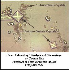 Crystals and amorphous sediment in urine! | Medical laboratory science, Medical laboratory ...