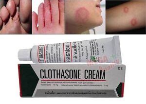 CLOTHASONE CREAM Antifungal Corticosteroid for Tinea Ringworm Athlete ...