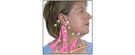 Swollen Lymph Nodes In Front Of Neck