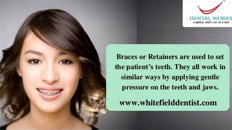 Orthodontic Braces In Bangalore | Misaligned Teeth Treatment In India