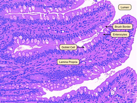 histology of intestinal lumen - Google Search | Human anatomy and ...