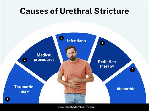 Urethral Stricture : causes, symptoms and treatment options