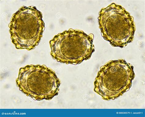 Eggs of Ascaris Lumbricoides (roundworm) Stock Image - Image of liver, cestode: 80030579