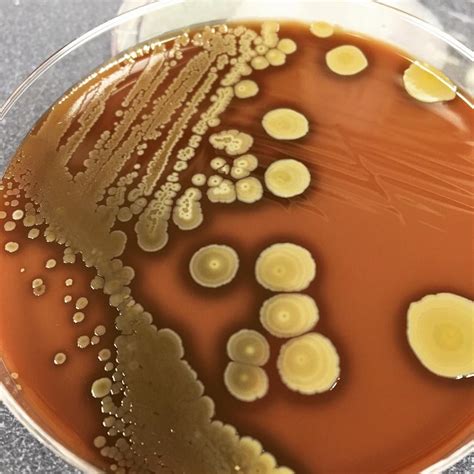 Staph aureus on chocolate agar. Seems odd that theres growth across the plate but has an area of ...