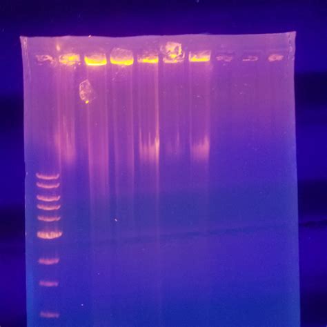 Agarose Gel Electrophoresis /Run – BGENZ Official Website