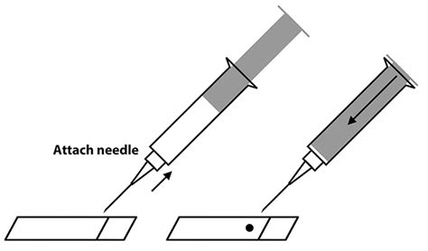 Fine-Needle Biopsy for Cytology