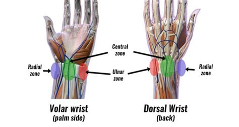 Sprained Wrist - Symptoms, Causes, Treatment and Rehabilitation