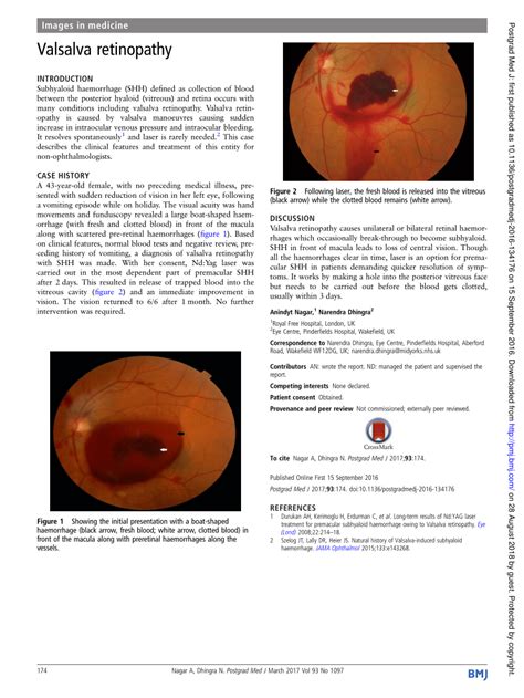 (PDF) Valsalva retinopathy