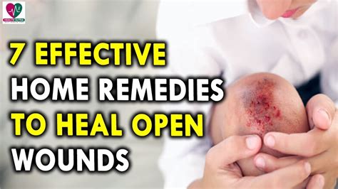 Home Remedies to Heal Open Wounds - Best Health Tips for Men and Womens ...