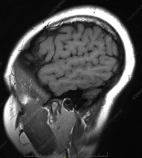 Superior temporal sulcus, MRI - Stock Image - C039/3590 - Science Photo Library