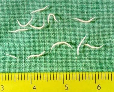 Pinworm (Enterobiasis): Practice Essentials, Etiology, Transmission