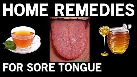 Best 6 Home Remedies for Sore Tongue - YouTube