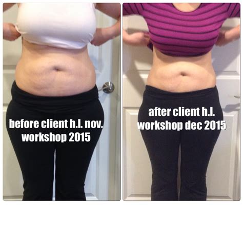 All New Before and After Pictures – Healing the Diastasis Recti 2015 – Beautiful After the Belly