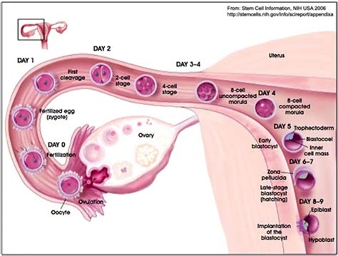 Pain After Laparoscopic Surgery For Ectopic Pregnancy - PregnancyWalls