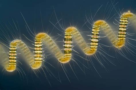 Chaetoceros debilis (marine diatom), a colonial plankton organism | Nikon Small World