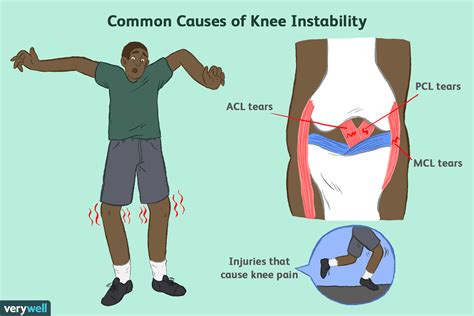 All Knee Ligaments