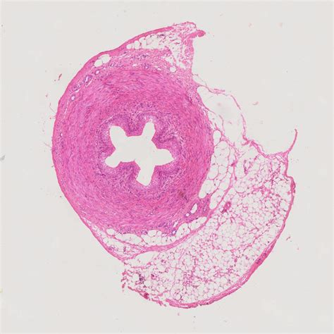 Human Ureter cross-section histology slides, 7 µm sec., H&E Stain, human histology slides ...