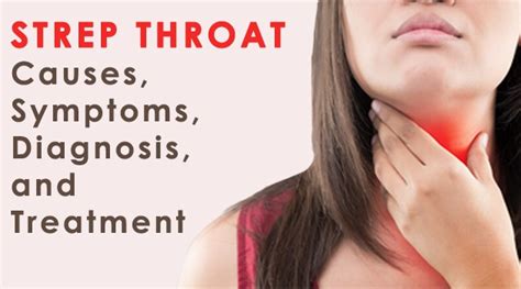 Strep Throat: Causes, Symptoms, Diagnosis, and Treatment.