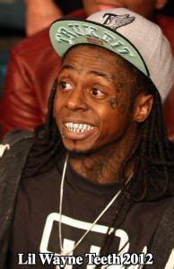 Lil Wayne Teeth - Diamonds Make His Words Precious! - Latest Plastic Surgery Gossip And News ...